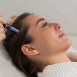 Alma TED Treatment Sessions for thinning hair